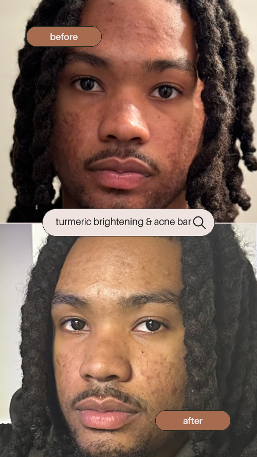 Turmeric Glow Bar